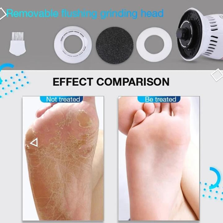 Electric Vacuum Adsorption Foot Grinder ??HOT DEAL - 50% OFF??