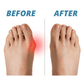 Premium Bunion Corrector Sock ??SALE 50% OFF??